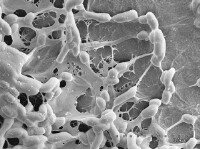 Bacterial glue