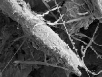 Fungal hyphae - enmeshing decomposing straw residue